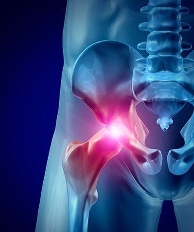 fotografija boli u kuku 1