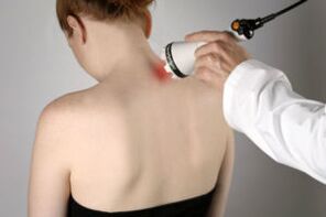 fizioterapija za osteohondrozu